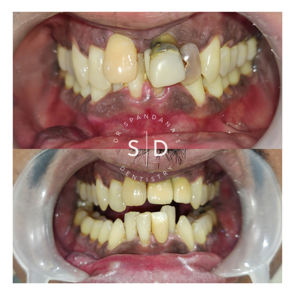 Dr. Spandana's Dentistry, All kinds of Tooth treatments in Hyderabad