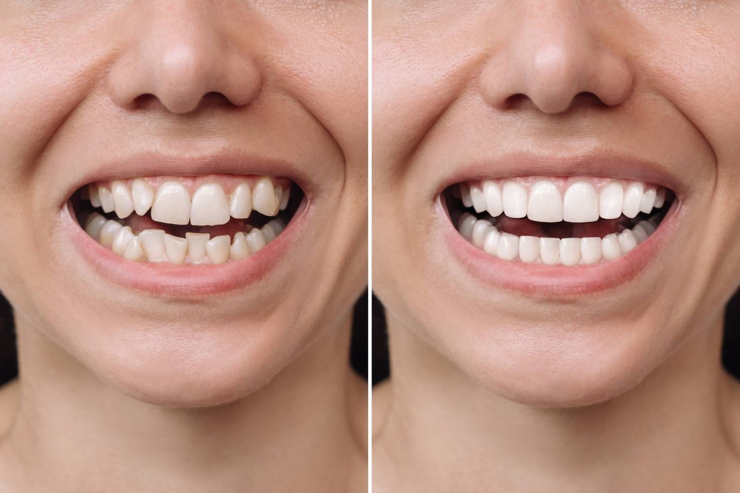 image - Dr. Spandanas Dentistry - Dr. Spandanas Dentistry