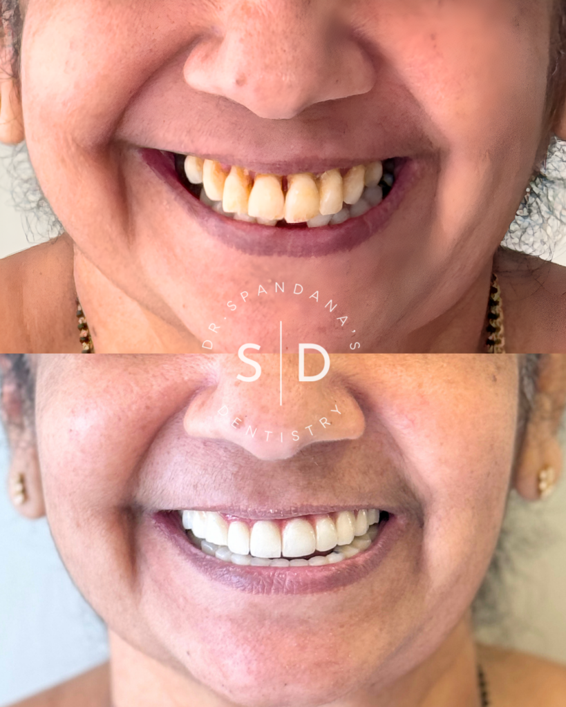Best dental implant clinic in khajaguda