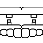 Solid black image filling the frame, no visible content.