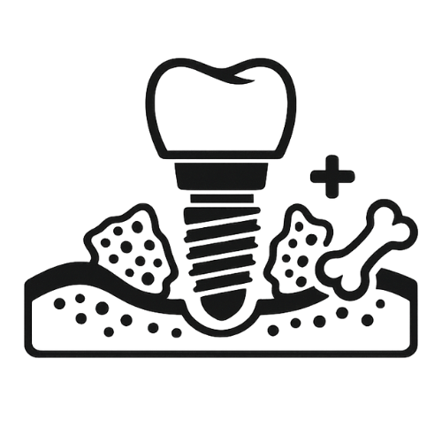 Icon of a dental implant: a tooth crown atop a screw-like implant embedded in gum tissue with a small plus sign nearby, indicating dental augmentation.