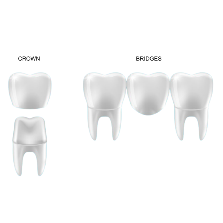 Five white molar teeth on a black background: one standalone tooth in the upper-left and four teeth in a row on the right, forming a dental illustration