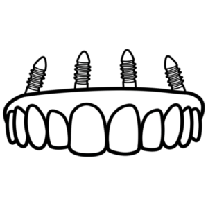 Silhouette of an upper jaw showing four dental implants protruding above a row of teeth, illustrating dental implant support.