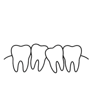 crowding - Dr. Spandanas Dentistry - Dr. Spandanas Dentistry Line drawing of four molar teeth connected in a row on a white background, a simple dental illustration.