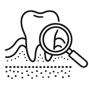 gums - Dr. Spandanas Dentistry - Dr. Spandanas Dentistry Line drawing of a tooth being inspected with a magnifying glass, focusing on dental plaque dots beneath it.