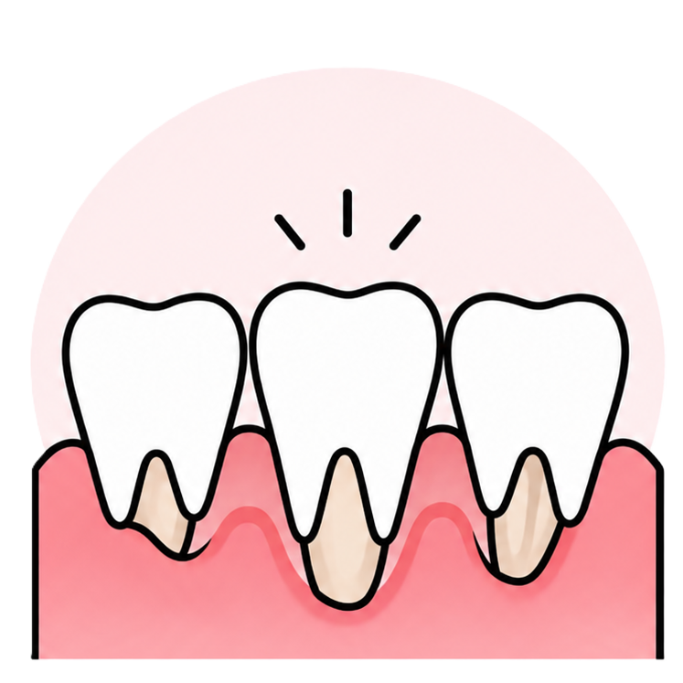 Cartoon of three upper front teeth with receding gums exposing roots, highlighting dental health issue