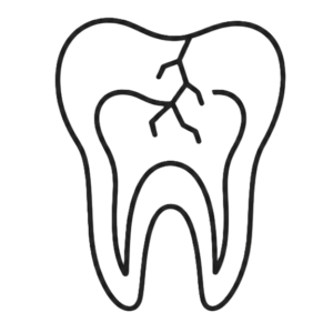 wrong-rct - Dr. Spandanas Dentistry - Dr. Spandanas Dentistry Line drawing of a tooth cross-section showing the pulp chamber and branching nerves inside the tooth